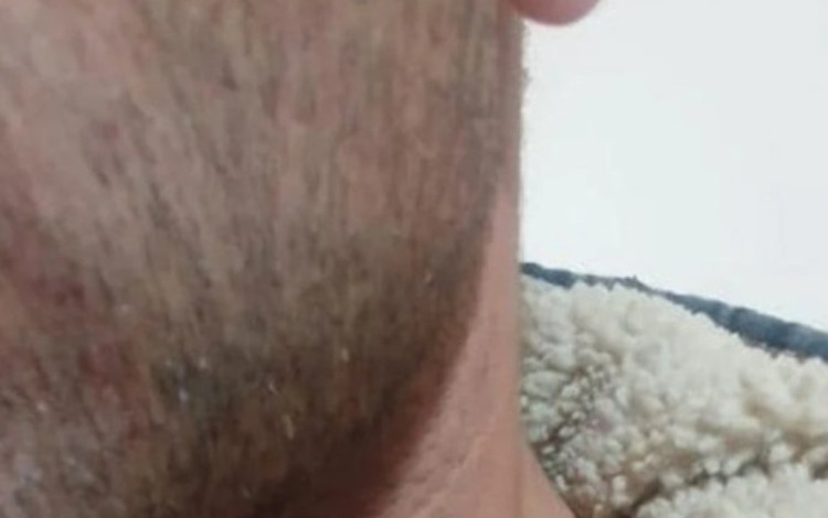 kriv_BRR_A.jpg